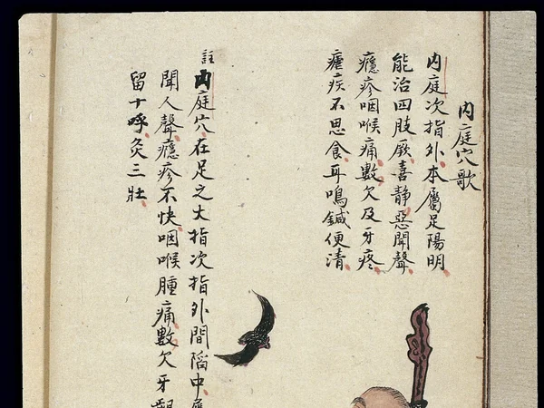 Nineteenth-century Chinese moxibustion point chart