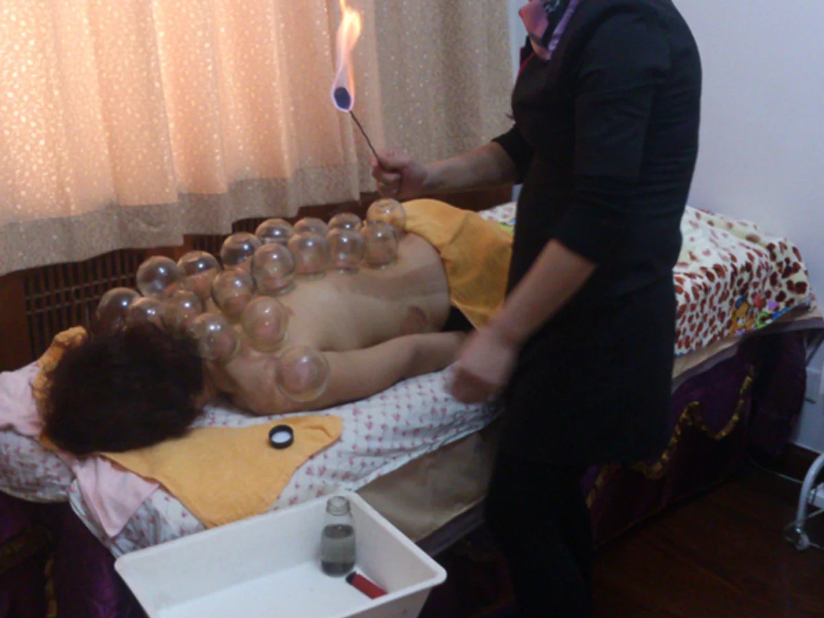 traditional chinese medicine traditional chinese medicine