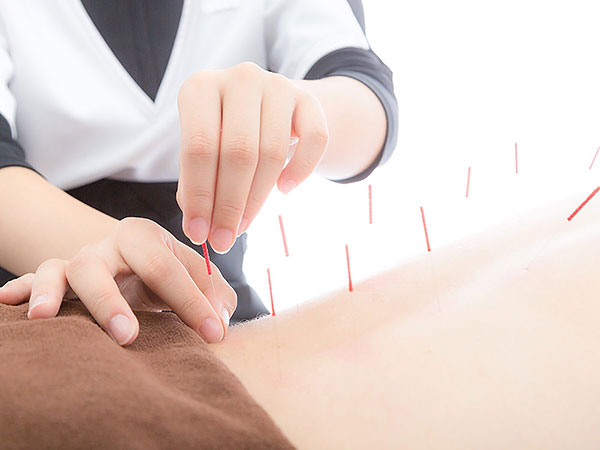 Acupuncture top reasons to visit china